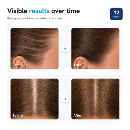 Be Bodywise Hair Growth Serum